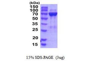 SDS-PAGE (SDS) image for Phosphoglucomutase 2 (PGM2) (AA 1-612) protein (His tag) (ABIN5854299) (Phosphoglucomutase 2 Protein (PGM2) (AA 1-612) (His tag))