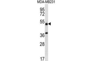 Western Blotting (WB) image for anti-Tripartite Motif Containing 10 (TRIM10) antibody (ABIN2996897)