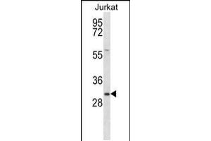 Western blot analysis in Jurkat cell line lysates (35ug/lane). (TMED8 antibody  (AA 154-182))