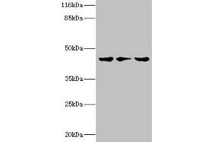 Western blot All lanes: PSKH2 antibody at 2 μg/mL Lane 1: Hela whole cell lysate Lane 2: Mouse heart tissue Lane 3: Rat gonad tissue Secondary Goat polyclonal to rabbit IgG at 1/10000 dilution Predicted band size: 44 kDa Observed band size: 44 kDa (PSKH2 antibody  (AA 63-320))
