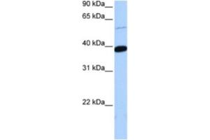 Western Blotting (WB) image for anti-Zinc Finger Protein 562 (ZNF562) antibody (ABIN2463443)
