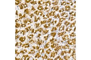 Immunohistochemistry of paraffin-embedded Rat stomach using  antibody (ABIN7265531) at dilution of 400 (40x lens). (ALDH1A1 antibody)
