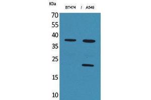 Western Blotting (WB) image for anti-Interferon, alpha 1 (IFNA1) (C-Term) antibody (ABIN3180993)