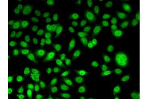 Immunofluorescence analysis of U2OS cells using PPL antibody (ABIN5974178).