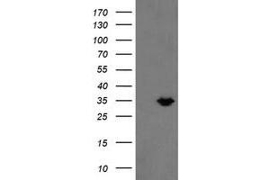 Image no. 1 for anti-Methylmalonic Aciduria (Cobalamin Deficiency) CblC Type, with Homocystinuria (MMACHC) antibody (ABIN1499515) (MMACHC antibody)
