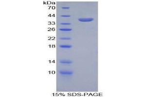 SDS-PAGE (SDS) image for Carboxypeptidase B1 (Tissue) (CPB1) (AA 109-415) protein (His tag) (ABIN2124230)