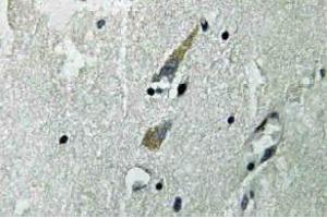 Immunohistochemistry (IHC) analyzes of Raf-1 antibody in paraffin-embedded human brain tissue. (RAF1 antibody)