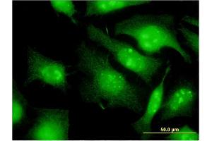 Immunofluorescence of monoclonal antibody to EIF2S3 on HeLa cell. (EIF2S3 antibody  (AA 383-472))
