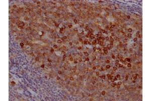 IHC image of ABIN7127402 diluted at 1:100 and staining in paraffin-embedded human tonsil tissue performed on a Leica BondTM system. (Recombinant CD38 antibody)