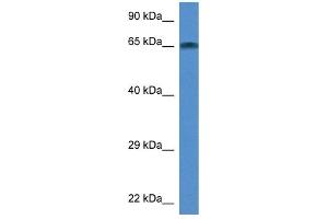 WB Suggested Anti-Taf6l Antibody Titration: 1. (TAF6L antibody  (Middle Region))