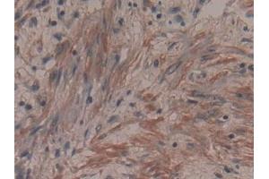 Immunohistochemistry (IHC) image for anti-Anoctamin 6 (ANO6) (AA 744-824) antibody (ABIN7436141)