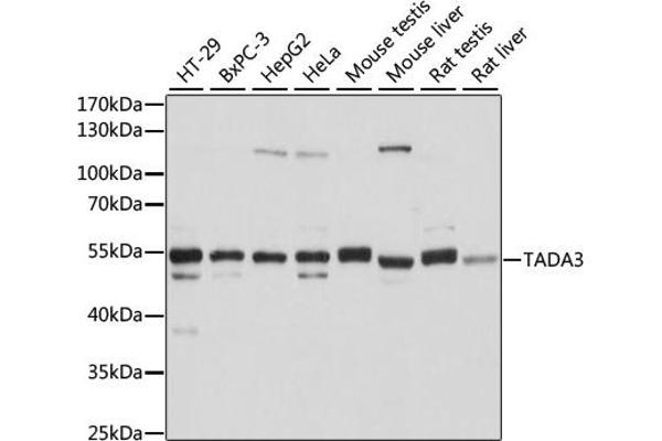 TADA3L antibody  (AA 270-369)