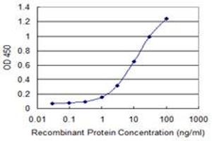 Detection limit for recombinant GST tagged LNX1 is 0. (LNX1 antibody  (AA 19-118))