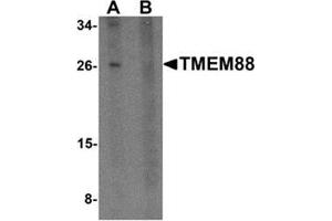 Western blot analysis of TMEM88 in human brain tissue lysate with TMEM88 antibody at 1 μg/ml in (A) the absence and (B) the presence of blocking peptide.