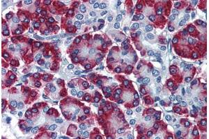 Human Pancreas: Formalin-Fixed, Paraffin-Embedded (FFPE) (SSR1 antibody  (AA 33-287))