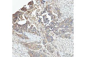 IHC analysis of SNX1 using anti-SNX1 antibody (ABIN7602548).