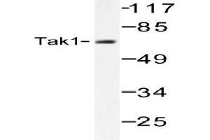 Western blot (WB) analysis of Tak1 antibody in extracts from HepG2 cells. (TR4 antibody)