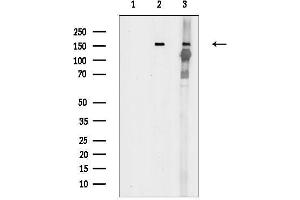 Western blot analysis of lysates from various samples, using Phospho-TIE2 (Tyr992) Antibody.