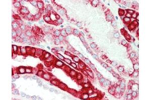 Human Kidney: Formalin-Fixed, Paraffin-Embedded (FFPE). (CRAT antibody  (AA 22-71))