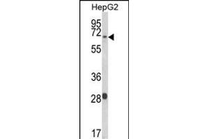 WAC Antikörper  (AA 284-313)