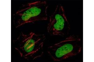 Fluorescent image of HeLa cell stained with HDAC1 antibody at 1:25. (HDAC1 antibody  (AA 449-482))