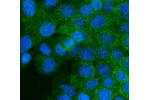 IF analysis of IGF2R using anti-IGF2R antibody (ABIN5693085).