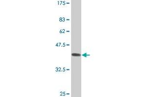 Western Blot detection against Immunogen (37. (STMN2 antibody  (AA 73-179))