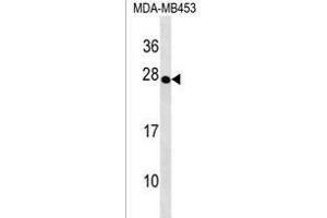 TRDC Antibody (Center) (ABIN1538630 and ABIN2838134) western blot analysis in MDA-M cell line lysates (35 μg/lane). (TRDC antibody  (AA 79-106))