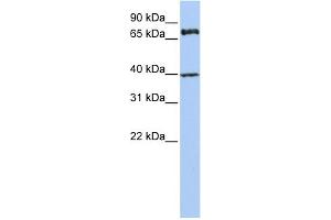 WB Suggested Anti-MPP5 Antibody Titration:  0.