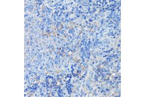 Immunohistochemistry of paraffin-embedded rat spleen using CR2/CD21 antibody (ABIN6132246, ABIN6138992, ABIN6138993 and ABIN6224458) at dilution of 1:100 (40x lens). (CD21 antibody  (AA 300-590))