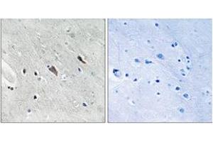 Immunohistochemistry (IHC) image for anti-GRB2-Associated Binding Protein 2 (GAB2) (AA 609-658), (pTyr643) antibody (ABIN1532144)