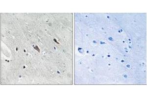 Immunohistochemistry analysis of paraffin-embedded human brain, using Gab2 (Phospho-Tyr643) Antibody. (GAB2 antibody  (pTyr643))