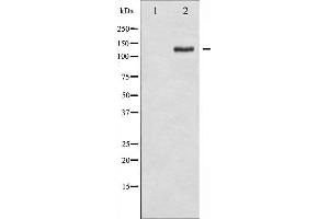 Western blot analysis of FAK phosphorylation expression in 293 whole cell lysates,The lane on the left is treated with the antigen-specific peptide. (FAK antibody  (pTyr925))