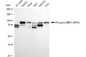 Western blotting analysis using phospho-MSK1 (S376) antibody (ABIN7800235).