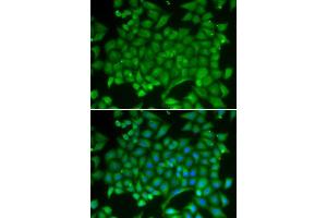 Immunofluorescence analysis of MCF-7 cell using RAB11A antibody.