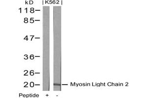 Image no. 2 for anti-Myosin, Light Chain 2, Regulatory, Cardiac, Slow (MYL2) (AA 16-20) antibody (ABIN197362)