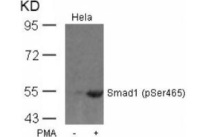 Image no. 1 for anti-SMAD, Mothers Against DPP Homolog 1 (SMAD1) (pSer465) antibody (ABIN319258) (SMAD1 antibody  (pSer465))