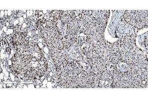 IHC analysis of MCM6 using anti-MCM6 antibody (ABIN7600036).