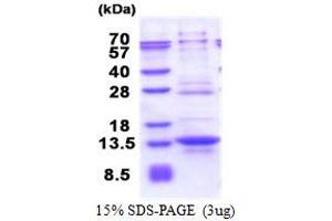 SDS-PAGE (SDS) image for Interferon Regulatory Factor 5 (IRF5) (AA 176-240) protein (His tag) (ABIN6387405)