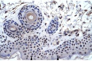 Human Skin; ZNF660 antibody - C-terminal region in Human Skin cells using Immunohistochemistry (ZNF660 antibody  (C-Term))