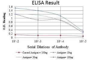 Red: Control Antigen (100 ng), Purple: Antigen (10 ng), Green: Antigen (50 ng), Blue: Antigen (100 ng), (Aurora A antibody)