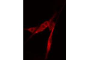 ABIN6274217 staining COLO205 cells by IF/ICC. (APEX1 antibody  (N-Term))