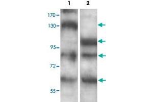 Western blot analysis of human fetal brain (Lane 1) and mouse brain (Lane 2) lysate with ADAMTS7 polyclonal antibody  at 1 : 500 dilution. (ADAMTS7 antibody  (C-Term))