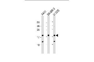 All lanes : Anti-THRSP Antibody (N-Term) at 1:2000 dilution Lane 1: A431 whole cell lysate Lane 2: SK-BR-3 whole cell lysate Lane 3: U-2OS whole cell lysate Lysates/proteins at 20 μg per lane.