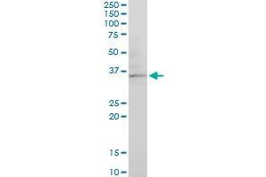 CHN1 monoclonal antibody (M03), clone 3A3. (CHN1 antibody  (AA 91-200))