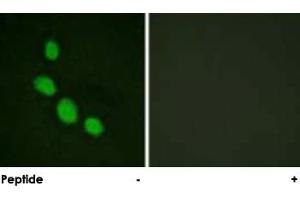 Immunofluorescence analysis of HeLa cells, using CEBPE polyclonal antibody . (CEBPE antibody)