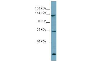 WB Suggested Anti-LATS1 Antibody Titration: 0. (LATS1 antibody  (Middle Region))