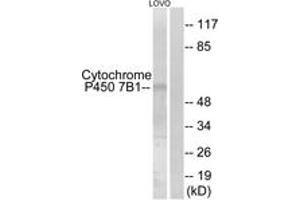 Western blot analysis of extracts from LOVO cells, using Cytochrome P450 7B1 Antibody.