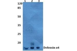 Western blot analysis of Defensin alpha 4 antibody at a 1/500 dilution. (DEFA4 antibody)