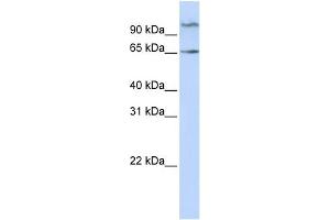WB Suggested Anti-NET1 Antibody Titration: 0. (NET1 antibody  (Middle Region))